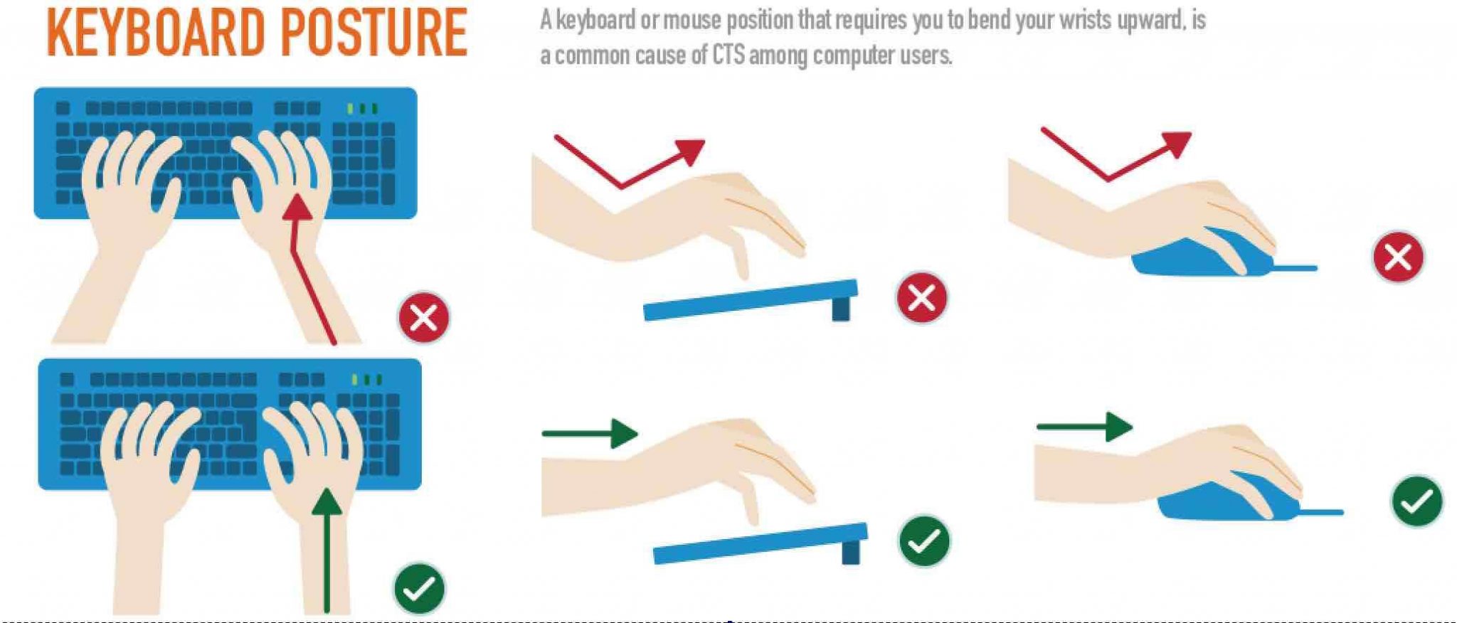 Computer use and Carpal tunnel syndrome